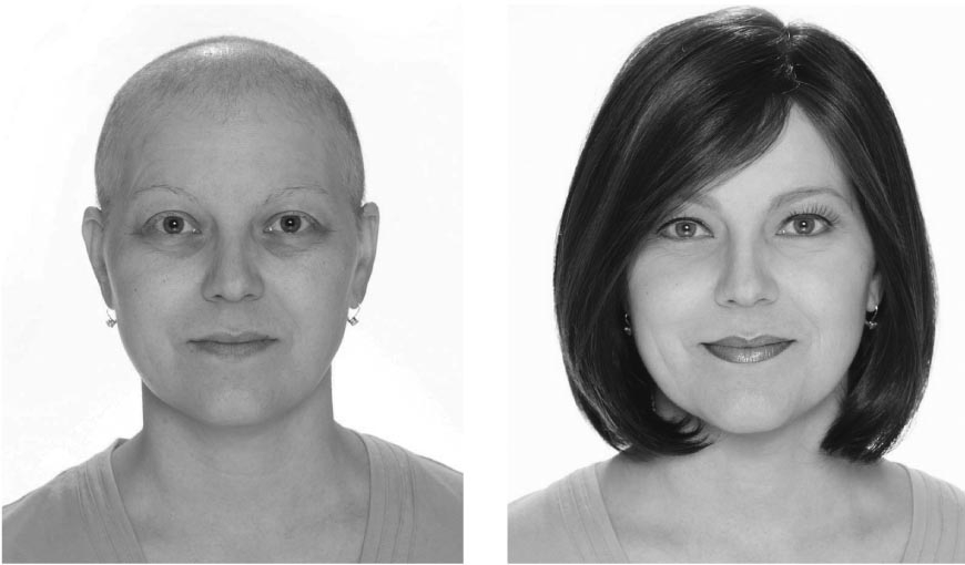 Looking and feeling better posttreatment