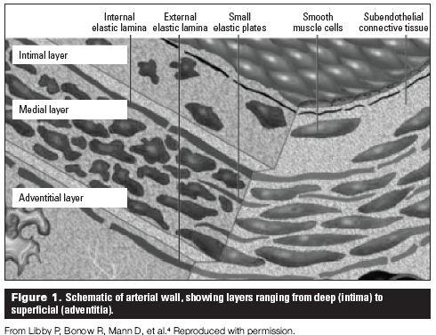 abdominal aortic aneurysm screening